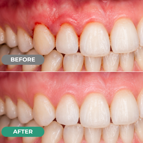 Advanced Periodontal Repair Gel – zarevoe