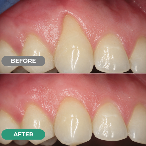 Advanced Periodontal Repair Gel – zarevoe