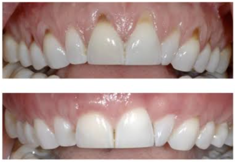 Advanced Periodontal Repair Gel – zarevoe
